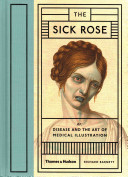 The sick rose, or, Disease and the art of medical illustration /
